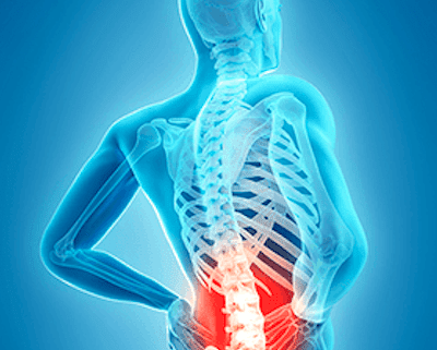 Tips in low back pain patients
